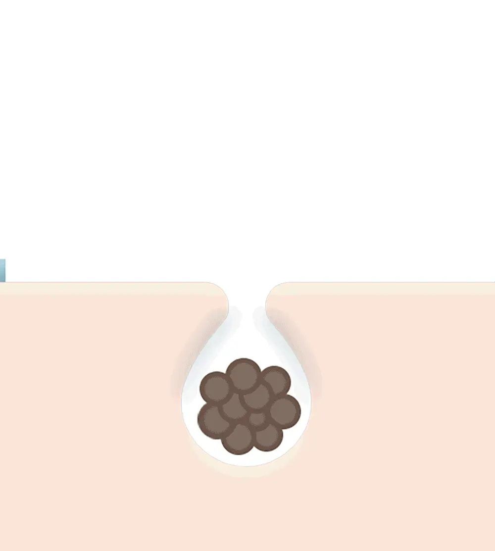 [보습민감/모공세정] 라곰 저자극 마이크로 포어  클렌징 오일 200ml 상세페이지 32